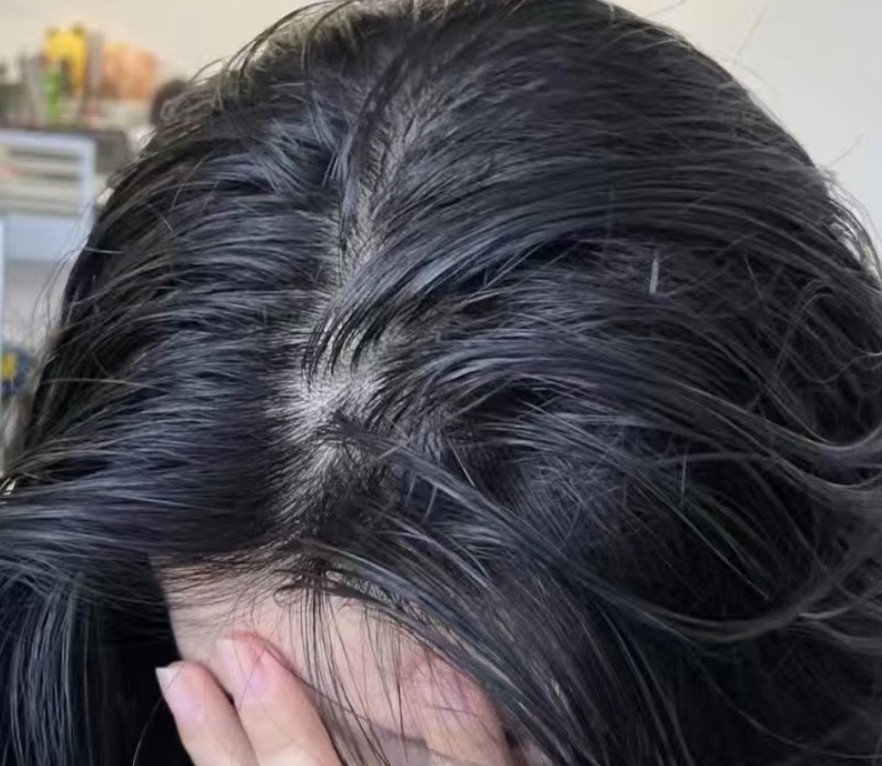 頭皮味洗不掉