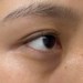 紫色黑眼圈怎麼遮
